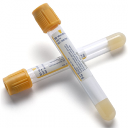 Tubo Vacutainer Amarillo 5ml Gradilla C/100 Piezas Ref: 368159 | PMHYL